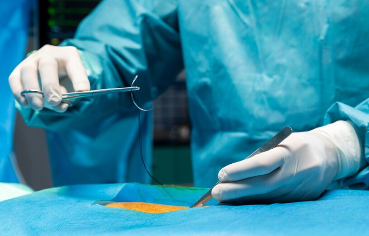 Reconstructive-and-burn-surgeries