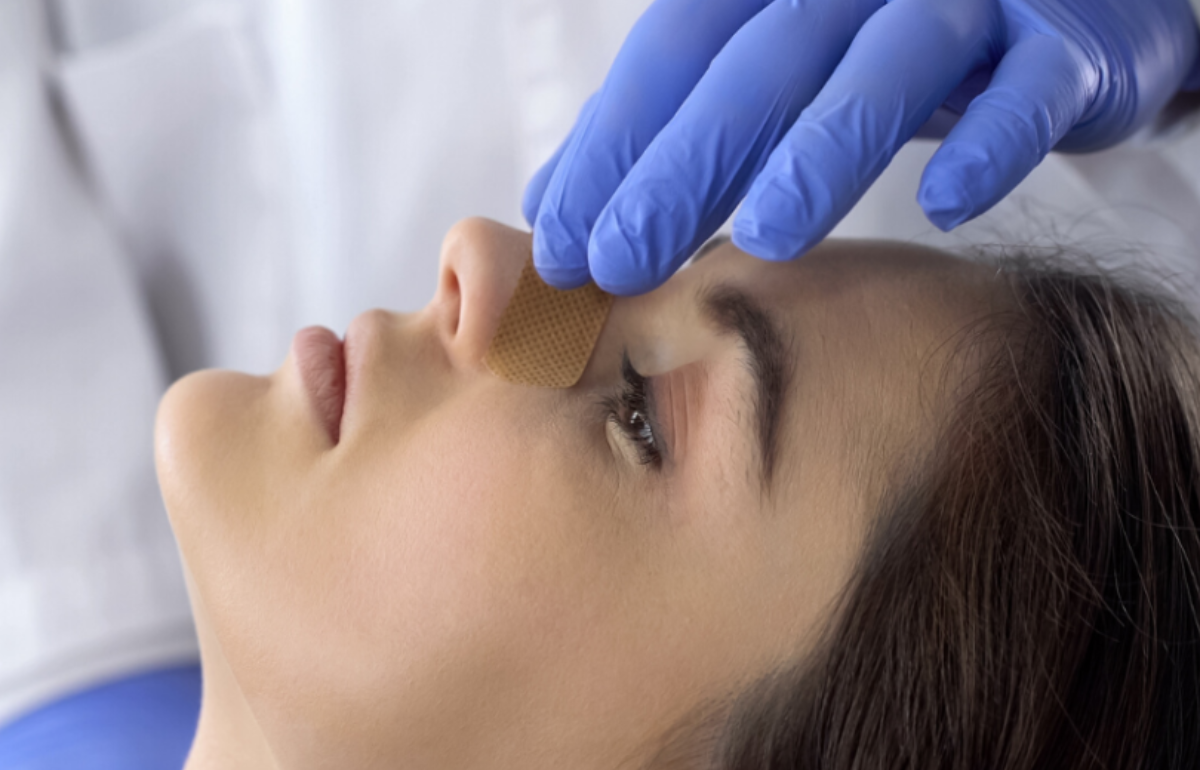 Rhinoplasty